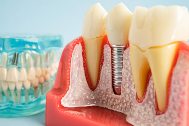 Best Dental Exams and Cleanings  in Hammond, LA