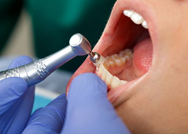 Best Wisdom Tooth Removal  in Hammond, LA